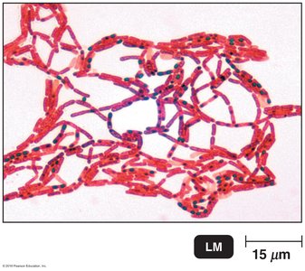 Gram-stained Bacillus anthracis