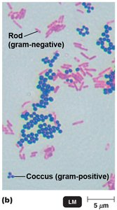 Gram staining results