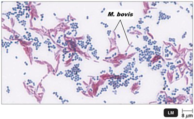 Acid-fast bacteria