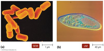 Examples of prokaryotic and eukaryotic cells