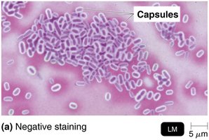 Negative staining for capsules