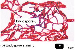 Endospore staining