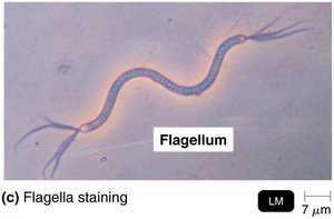 Flagella staining