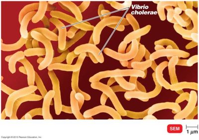 SEM of Vibrio cholerae