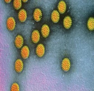 Norwalk virus particles