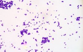 Microscopic image of purple-stained bacteria