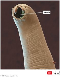 SEM of hookworm mouth