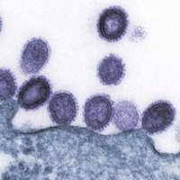 Influenza virus budding from cell