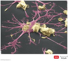 Dendritic cell engulfing and presenting antigen
