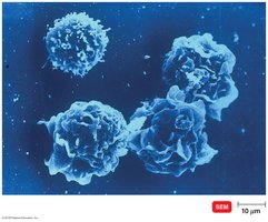 Activated macrophages