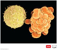 Apoptosis of a B cell