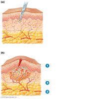Diagram of tissue damage and inflammation process