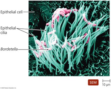 Bordetella attached to epithelial cilia
