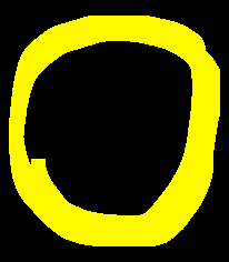 IgM pentamer structure