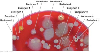 Bacterial colonies on agar