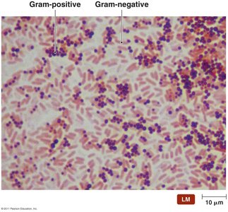 Results of Gram staining: Gram-positive and Gram-negative bacteria