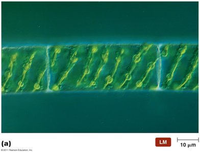 Spirogyra (green algae)