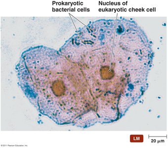 Streptococcus within a human cheek cell