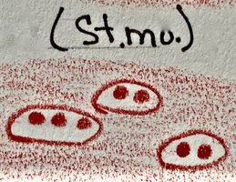 Capsule stain of Streptococcus mutans showing clear halos around cells