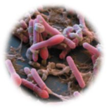 Clostridium botulinum under microscope