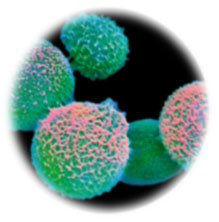 Cryptococcus neoformans under microscope