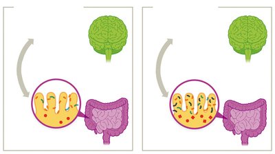 Gut-brain axis and microbiota influence on brain function