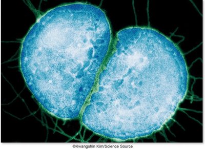 Neisseria meningitidis diplococcus