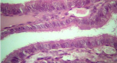 Pseudostratified columnar epithelium in trachea
