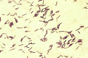 Gram-positive rods of Clostridium