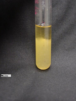 Thioglycollate broth showing growth patterns
