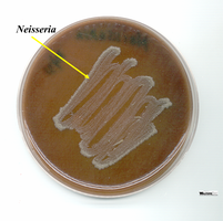 Neisseria colonies on chocolate agar
