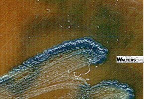 Positive oxidase test: purple coloration