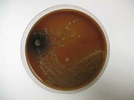 Neisseria on chocolate agar with oxidase test