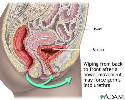 Diagram showing how improper wiping can introduce bacteria into the urethra