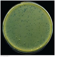 Viral plaques in a lawn of bacterial growth