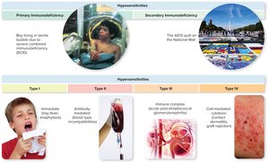 Overview of immune system disorders, including primary and secondary immunodeficiency and four types of hypersensitivities