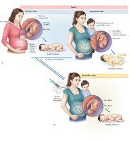 Development and control of Rh incompatibility in first and subsequent pregnancies