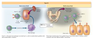 Diagram of host versus graft and graft versus host reactions in transplantation