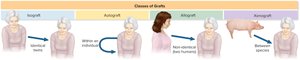 Diagram showing isograft, autograft, allograft, and xenograft transplantation