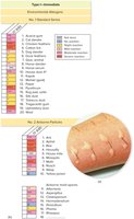 Skin prick test for allergy diagnosis and chart of common environmental allergens