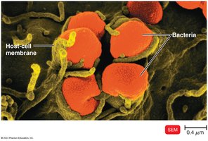 Neisseria gonorrhoeae interacting with host cells