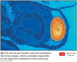 Coxiella burnetii, cause of Q fever