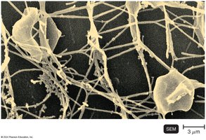 Archaea diversity