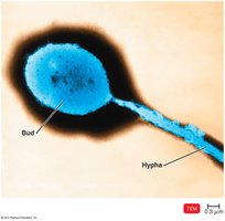 Hyphomicrobium budding bacterium