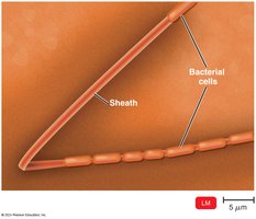 Sphaerotilus natans with sheath and bacterial cells