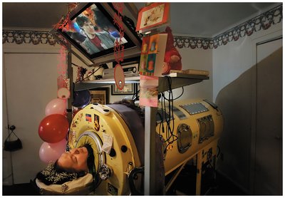 Patients in iron lungs during polio epidemics