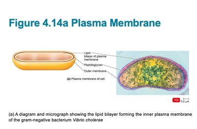 Diagram and TEM image of plasma membrane in Vibrio cholerae