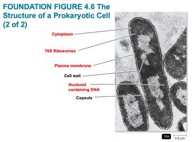 TEM image of prokaryotic cell showing nucleoid, ribosomes, plasma membrane, cell wall, and capsule