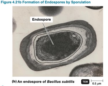 TEM image of Bacillus subtilis endospore