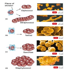 SEM images of cocci arrangements: diplococci, streptococci, tetrad, sarcinae, staphylococci